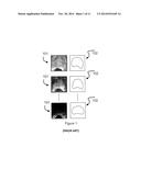 COMPUTER SYSTEM AND METHOD FOR ATLAS-BASED CONSENSUAL AND CONSISTENT     CONTOURING OF MEDICAL IMAGES diagram and image