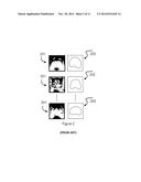 COMPUTER SYSTEM AND METHOD FOR ATLAS-BASED CONSENSUAL AND CONSISTENT     CONTOURING OF MEDICAL IMAGES diagram and image