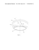 METHOD AND APPARATUS FOR AUTOMATED PLACEMENT OF SCANNED LASER     CAPSULORHEXIS INCISIONS diagram and image