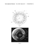 METHOD AND APPARATUS FOR AUTOMATED PLACEMENT OF SCANNED LASER     CAPSULORHEXIS INCISIONS diagram and image
