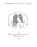 SYSTEM AND METHOD FOR EFFICIENT ASSESSMENT OF LESION DEVELOPMENT diagram and image