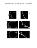 FULLY AUTOMATED LOCALIZATION OF ELECTROENCEPHALOGRAPHY (EEG) ELECTRODES diagram and image