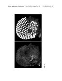 FULLY AUTOMATED LOCALIZATION OF ELECTROENCEPHALOGRAPHY (EEG) ELECTRODES diagram and image