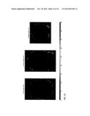 FULLY AUTOMATED LOCALIZATION OF ELECTROENCEPHALOGRAPHY (EEG) ELECTRODES diagram and image