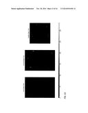 FULLY AUTOMATED LOCALIZATION OF ELECTROENCEPHALOGRAPHY (EEG) ELECTRODES diagram and image