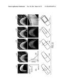 Methods, Systems and Computer Program Products for Diagnosing Conditions     Using Unique Codes Generated from a Multidimensional Image of a Sample diagram and image