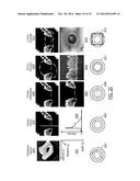 Methods, Systems and Computer Program Products for Diagnosing Conditions     Using Unique Codes Generated from a Multidimensional Image of a Sample diagram and image