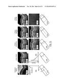 Methods, Systems and Computer Program Products for Diagnosing Conditions     Using Unique Codes Generated from a Multidimensional Image of a Sample diagram and image