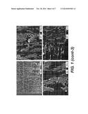 Compositions and Methods Comprising Biodegradable Scaffolds and Retinal     Pigment Epithelial Cells diagram and image