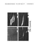 Compositions and Methods Comprising Biodegradable Scaffolds and Retinal     Pigment Epithelial Cells diagram and image