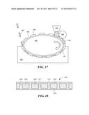 Micromold Methods For Fabricating Perforated Substrates and for Preparing     Solid Polymer Electrolyte Composite Membranes diagram and image