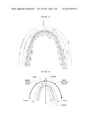 CLASS II/III CORRECTOR ACCOMODATING BITE PLATES diagram and image