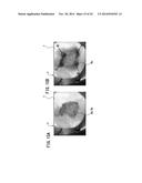 DENTAL IMAGE DISPLAY DEVICE, DENTAL SURGICAL OPERATION DEVICE, AND DENTAL     IMAGE DISPLAY METHOD diagram and image