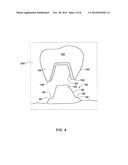 METHOD AND SYSTEM FOR PROVIDING FEEDBACK DATA USEFUL IN PROTHODONTIC     PROCEDURES ASSOCIATED WITH THE INTRA ORAL CAVITY diagram and image
