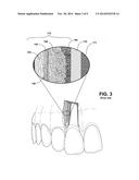 Device and Method for Treating Oral Pigmentation diagram and image