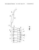 Device and Method for Treating Oral Pigmentation diagram and image