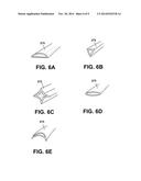 Device and Method for Treating Oral Pigmentation diagram and image