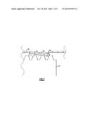 COAXIAL INTERFACE PORT ACCESSORY AND PORT FACILITATING SLIDE-ON     ATTACHMENT AND ROTATIONAL DETACHMENT OF CABLE CONNECTORS diagram and image