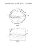 PROTECTIVE COVER FOR MEDICINE BALL AND METHODS OF MAKING THEREOF diagram and image