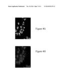 COMPOSITIONS, METHODS, AND KITS COMPRISING PLATINUM COMPOUNDS ASSOCIATED     WITH A LIGAND COMPRISING A TARGETING MOIETY diagram and image