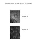 COMPOSITIONS, METHODS, AND KITS COMPRISING PLATINUM COMPOUNDS ASSOCIATED     WITH A LIGAND COMPRISING A TARGETING MOIETY diagram and image