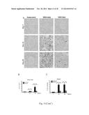 USE OF CITRAL FOR TREATING FOCAL SEGMENTAL GLOMERULOSCLEROSIS diagram and image