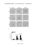 USE OF CITRAL FOR TREATING FOCAL SEGMENTAL GLOMERULOSCLEROSIS diagram and image