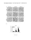 USE OF CITRAL FOR TREATING FOCAL SEGMENTAL GLOMERULOSCLEROSIS diagram and image