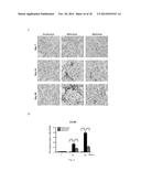 USE OF CITRAL FOR TREATING FOCAL SEGMENTAL GLOMERULOSCLEROSIS diagram and image