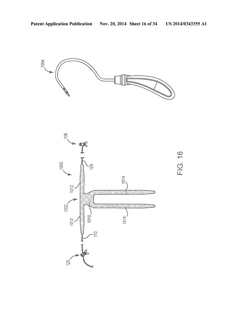 SACROCOLPOPEXY SUPPORT - diagram, schematic, and image 17