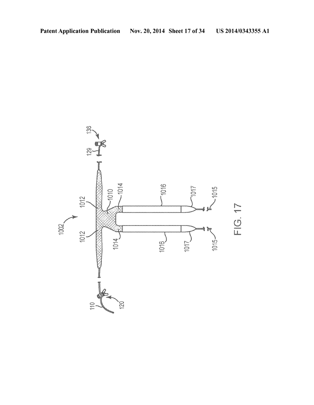 SACROCOLPOPEXY SUPPORT - diagram, schematic, and image 18