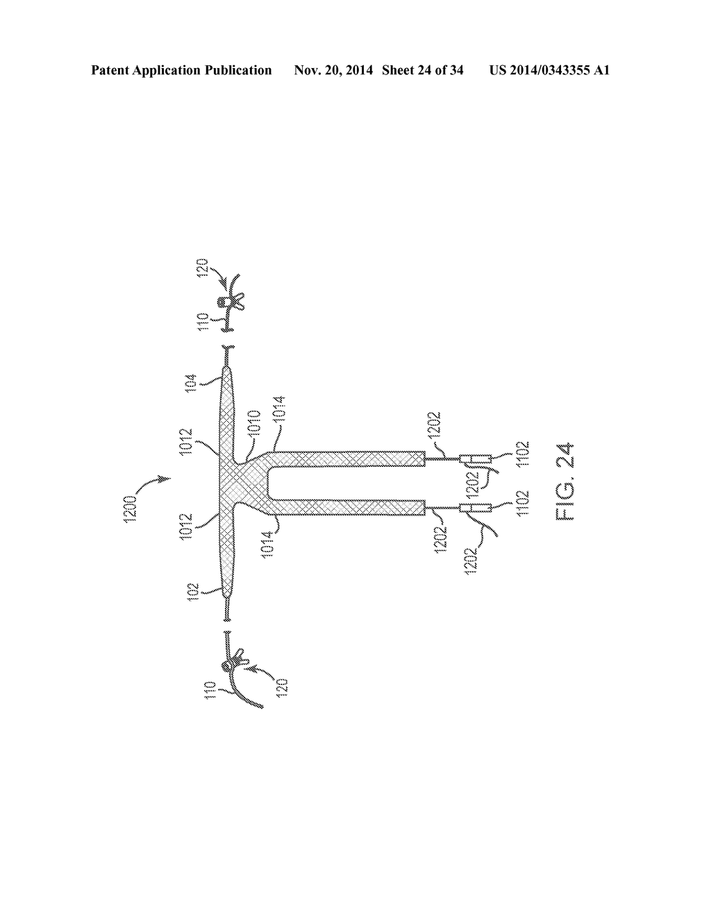 SACROCOLPOPEXY SUPPORT - diagram, schematic, and image 25