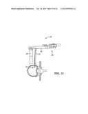 SURGICAL ACCESS SYSTEM AND RELATED METHODS diagram and image