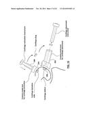 Patient-Specific Surgical Guidance Tool and Method of Use diagram and image