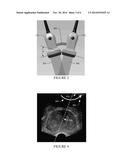 Ultrasound Imaging Console diagram and image