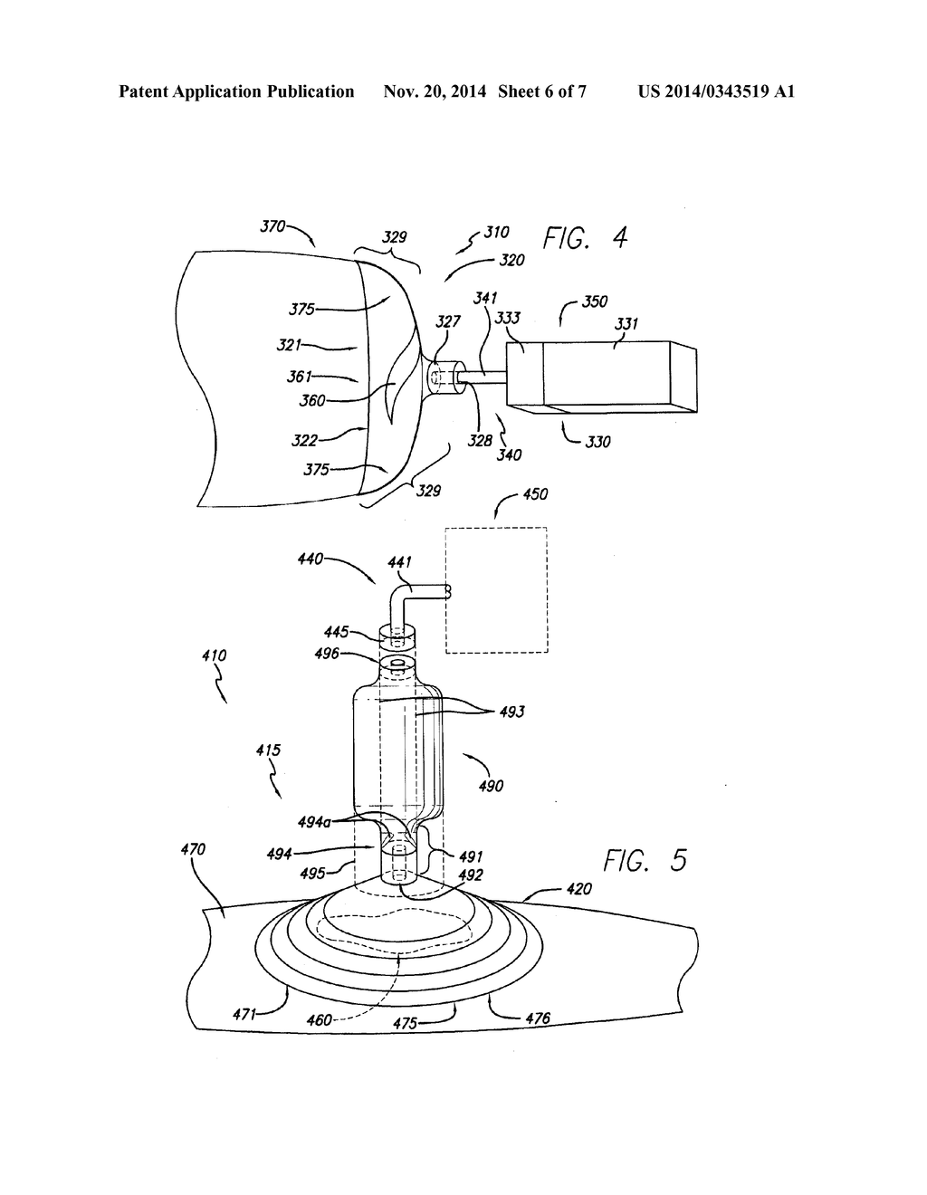 FLEXIBLE REDUCED PRESSURE TREATMENT APPLIANCE - diagram, schematic, and image 07