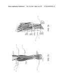 Methods, Systems, and Devices for Treating Neuromas, Fibromas, Nerve     Entrapment, and/or Pain Associated Therewith diagram and image