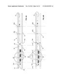 ENDOSTEAL NAIL PLATE FOR FIXING BONE SEGMENTS diagram and image