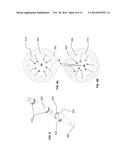 ENDOSTEAL NAIL PLATE FOR FIXING BONE SEGMENTS diagram and image