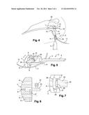 DEVICE FOR GUIDING PIERCING TOOLS FOR PLACING A GLENOID IMPLANT diagram and image