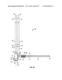 APPARATUS AND METHOD FOR MEASURING A LENGTH BETWEEN IMPLANTED BONE ANCHORS diagram and image