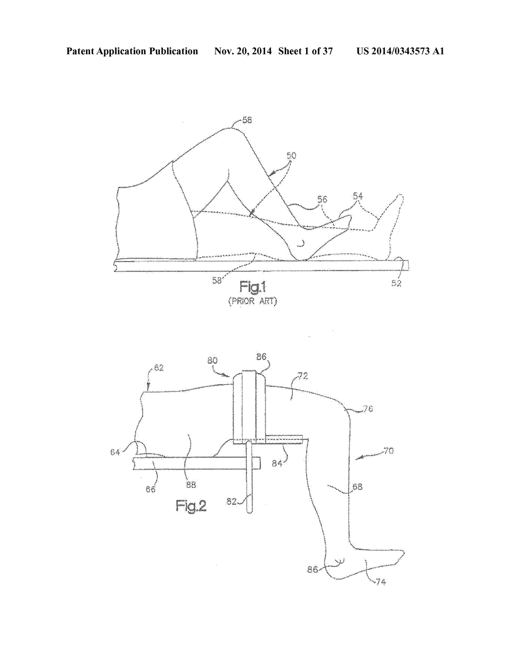 METHOD OF PREPARING A FEMUR AND TIBIA IN KNEE ARTHROPLASTY - diagram, schematic, and image 02