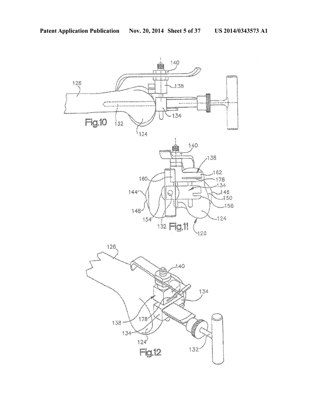 METHOD OF PREPARING A FEMUR AND TIBIA IN KNEE ARTHROPLASTY - diagram, schematic, and image 06