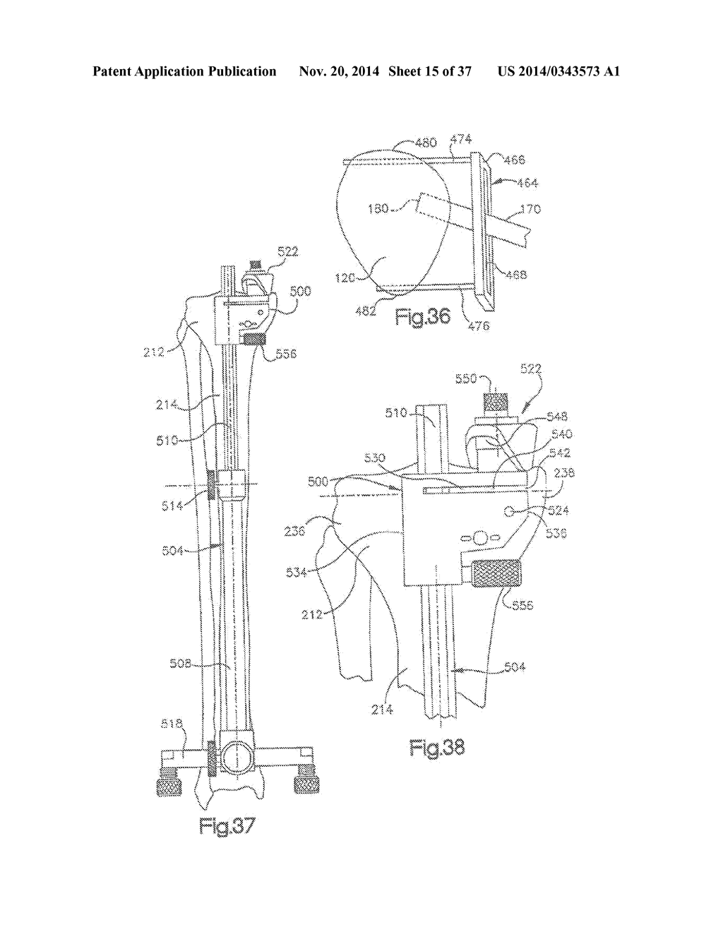 METHOD OF PREPARING A FEMUR AND TIBIA IN KNEE ARTHROPLASTY - diagram, schematic, and image 16