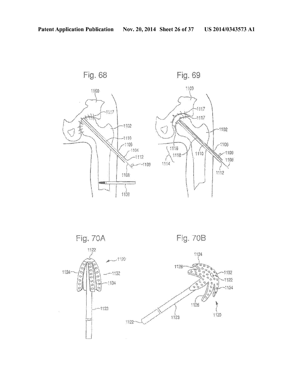 METHOD OF PREPARING A FEMUR AND TIBIA IN KNEE ARTHROPLASTY - diagram, schematic, and image 27