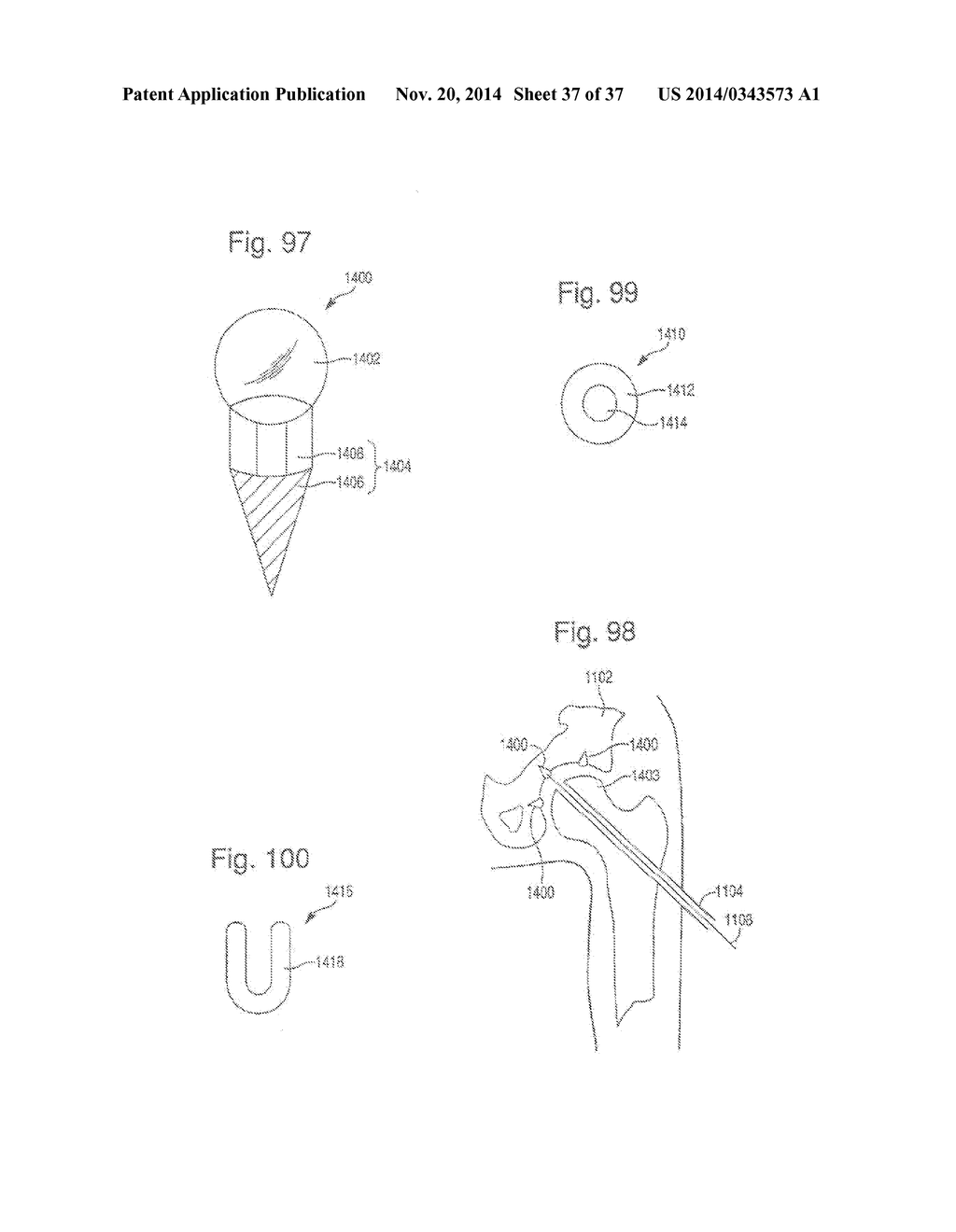 METHOD OF PREPARING A FEMUR AND TIBIA IN KNEE ARTHROPLASTY - diagram, schematic, and image 38