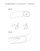 MEDICAL CLIP, CLIP UNIT AND CLIP DEVICE diagram and image