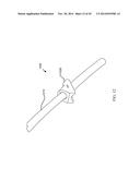 DEPLOYMENT TOOL FOR SUTURELESS VASCULAR ANASTOMOSIS CONNECTION diagram and image