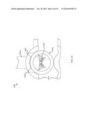 DEPLOYMENT TOOL FOR SUTURELESS VASCULAR ANASTOMOSIS CONNECTION diagram and image