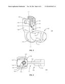 SPINAL CORRECTION SYSTEM diagram and image